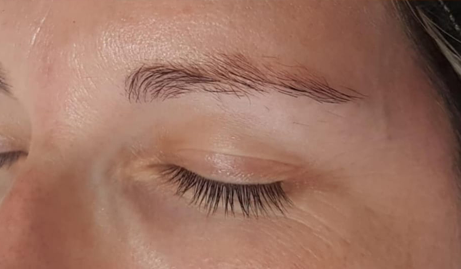 Phi Brows - Before Treatment